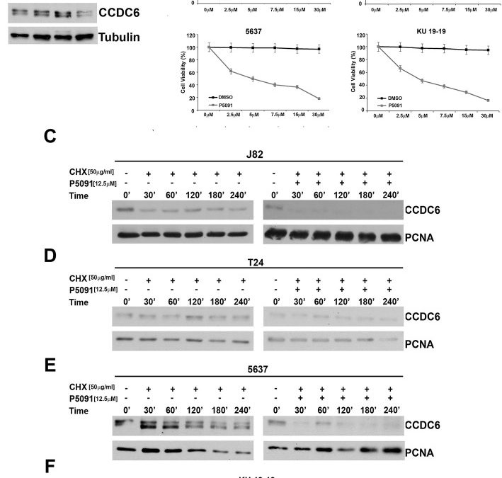 CCDC6 and USP7 expression levels suggest novel treatment options in high-grade urothelial bladder cancer.
